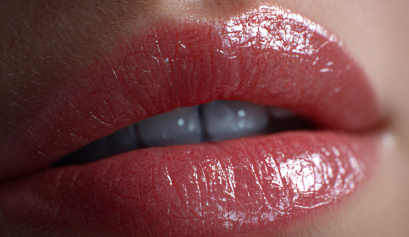 proceso aumento de labios, fases aumento de labios, inyección de labios para dar volumen y definición sin dolor, aumento de labios méxico