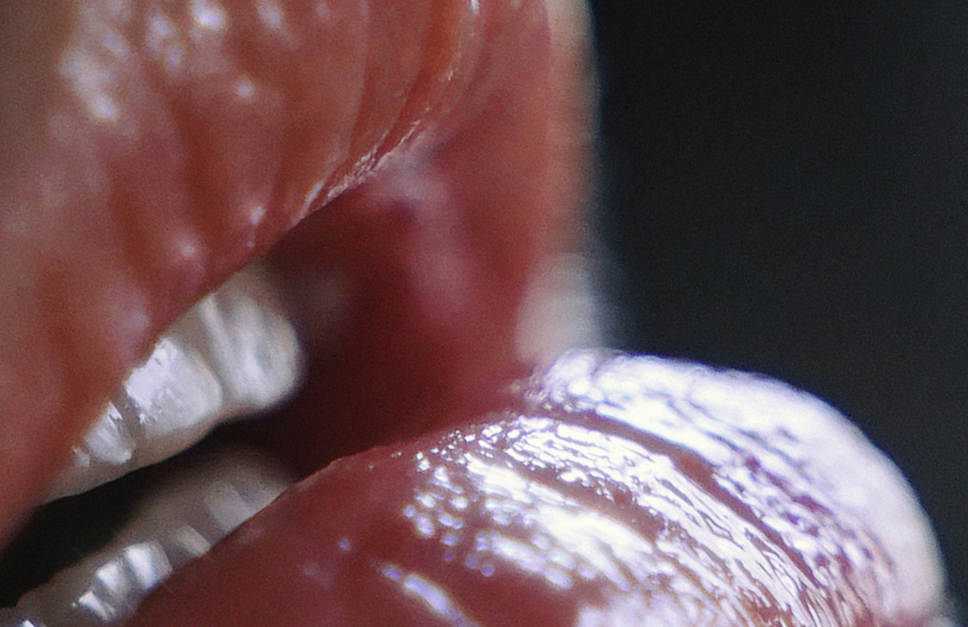 tratamientos ácido hialurónico madrid, clínicas medicina estética madrid, mav magazine