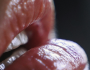tratamientos ácido hialurónico madrid, clínicas medicina estética madrid, mav magazine